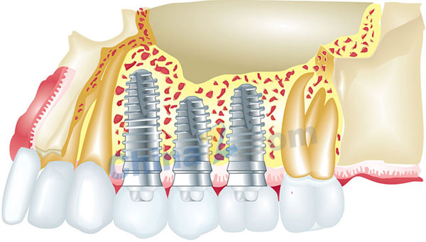 wulogo10439.jpg